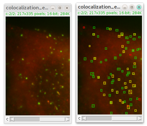 imagej colocalization analysis