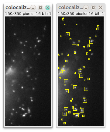 colocalization imagej