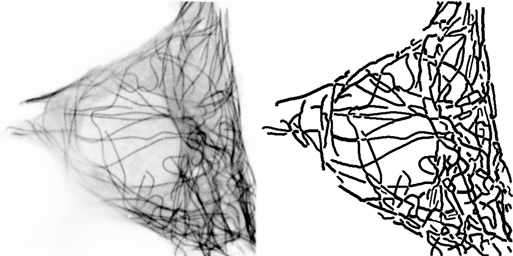 Microtubules (left) and result of tracing (right)